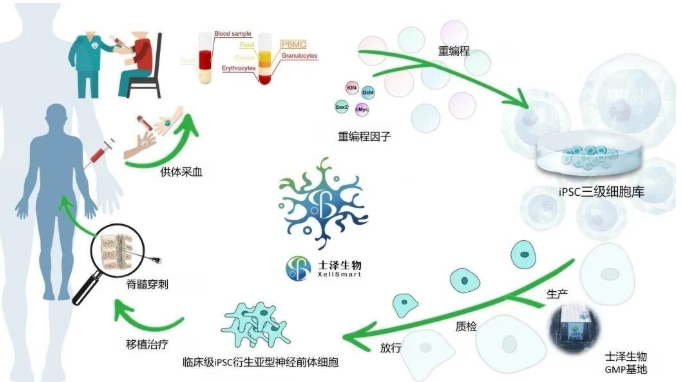 現(xiàn)貨型”iPSC衍生亞型神經(jīng)細胞新藥